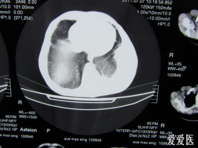 给大家爆料一下CT看穿仪怎样看穿普通碗里硬币 《新浪科技 讲解窍门》